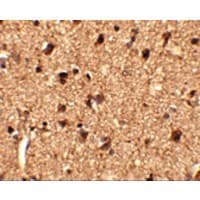 SLITRK1 Antibody