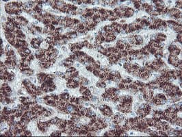 PECR Antibody (clone OTI1F2)