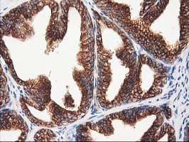 TUBB4 / Tubulin Beta 4 Antibody (clone 3C12, Carrier-free)