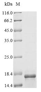 Leishmania donovani LDBPK Protein (Recombinant 6His, N-terminus)