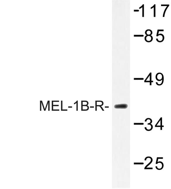 MTNR1B / MT2 Antibody (Val39)