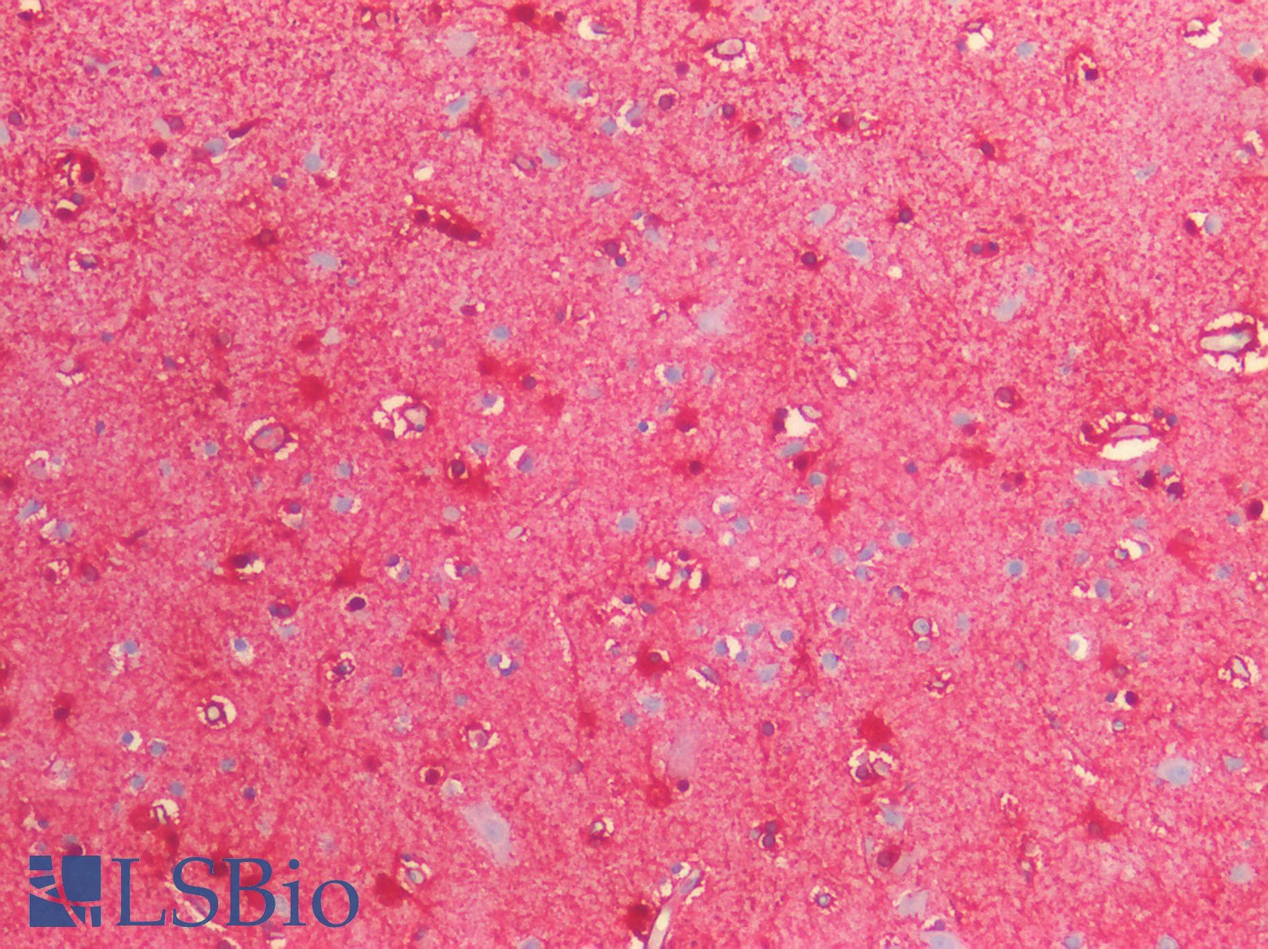 PathPlus™ Polyclonal Goat anti-Human S100B / S100 Beta Antibody (Internal Region, IHC, WB)