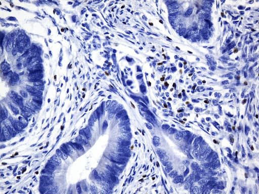 FOXP3 Antibody (clone UMAB248)