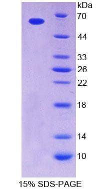 Human TPK1 Protein (Recombinant His-GST)