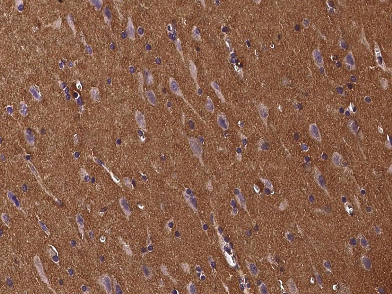 SNCB / Beta-Synuclein Antibody