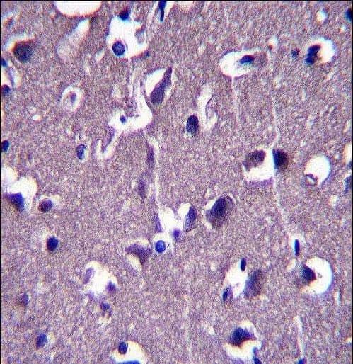 Polyclonal Rabbit anti-Human GRID1 Antibody (aa846-875, IHC, WB)