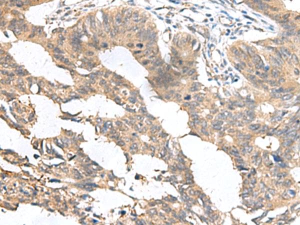 Polyclonal Rabbit anti-Human MIA / CD-RAP Antibody (IHC)