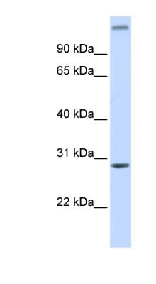 ABH2 / ALKBH2 Antibody (aa108-157)