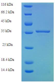 Human MRPL11 Protein (Recombinant His-SUMO)