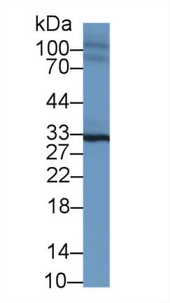 SPRY2 / Sprouty 2 Antibody (aa116-305, APC)