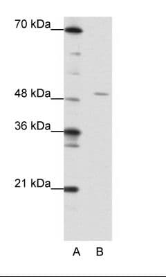 Polyclonal Rabbit anti-Human HMG20A Antibody (aa181-230, WB)