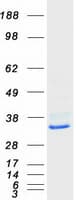 Human CLPP Protein (Recombinant Myc-DDK (Flag))