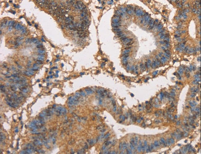 HK3 / Hexokinase 3 Antibody
