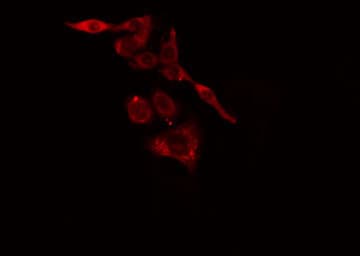 Polyclonal Rabbit anti-Human KRT37 + KRT38 Antibody (IF, WB)