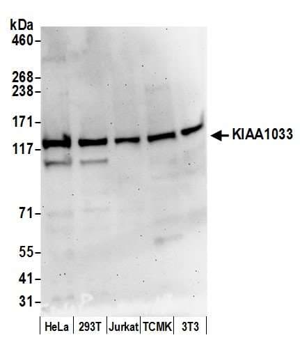 Polyclonal Rabbit anti-Human KIAA1033 Antibody (aa1123-1173, WB)