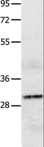 IL2RA / CD25 Antibody