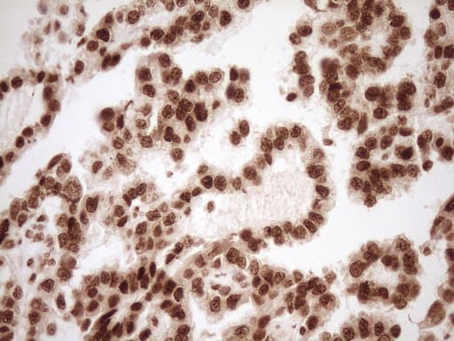 NUDT21 Antibody (aa2-227, clone OTI5B3)