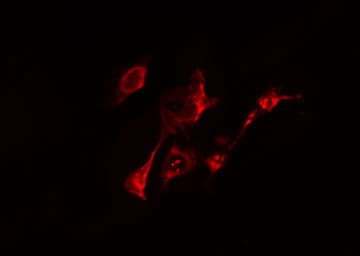 Polyclonal Rabbit anti-Human RAB20 Antibody (IF, WB)