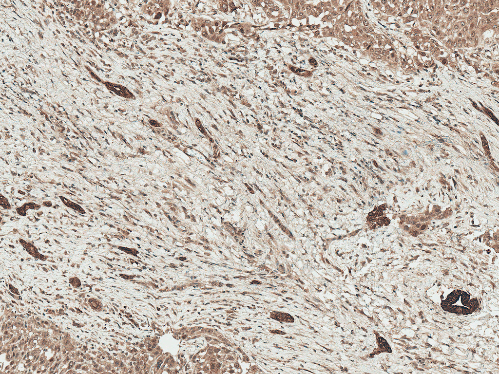 LRP1 / CD91 Antibody (Biotin)