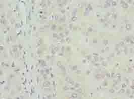 Polyclonal Rabbit anti-Human TPPP2 Antibody (IHC, WB)