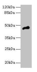 CASQ1 / Calsequestrin 1 Antibody