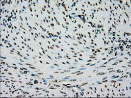Monoclonal Mouse anti-Human PMEL / SILV / gp100 Antibody (clone OTI10E5, IHC, IF, WB)