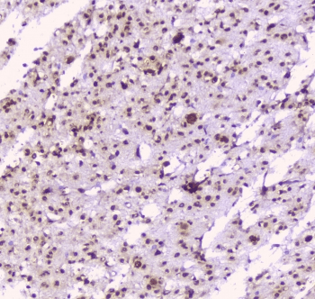 NOVA1 Antibody