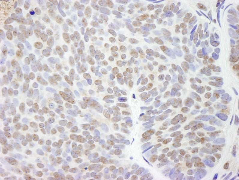 UBE2L3 / UBCH7 Antibody (aa100-C-term)