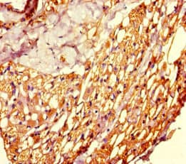 Polyclonal Rabbit anti-Human SETD8 / SET8 Antibody (IHC)