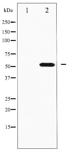 RPS6KB2 / S6K2 Antibody (phospho-Ser423)