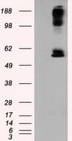 LIPG / Endothelial Lipase Antibody (clone OTI9C5)