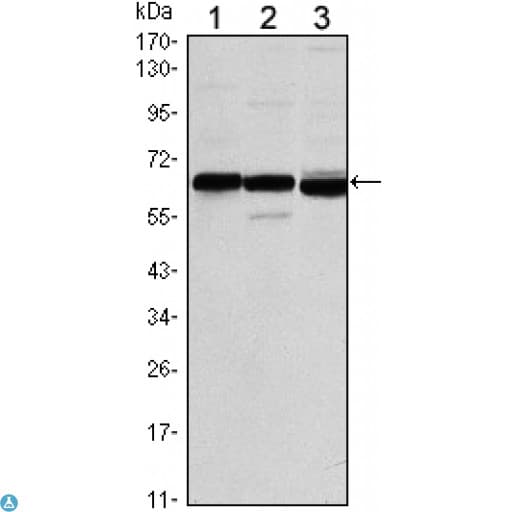 ER Alpha / Estrogen Receptor Antibody