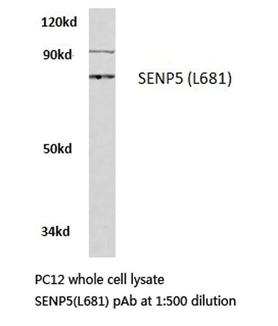 SENP5 Antibody (Leu681)