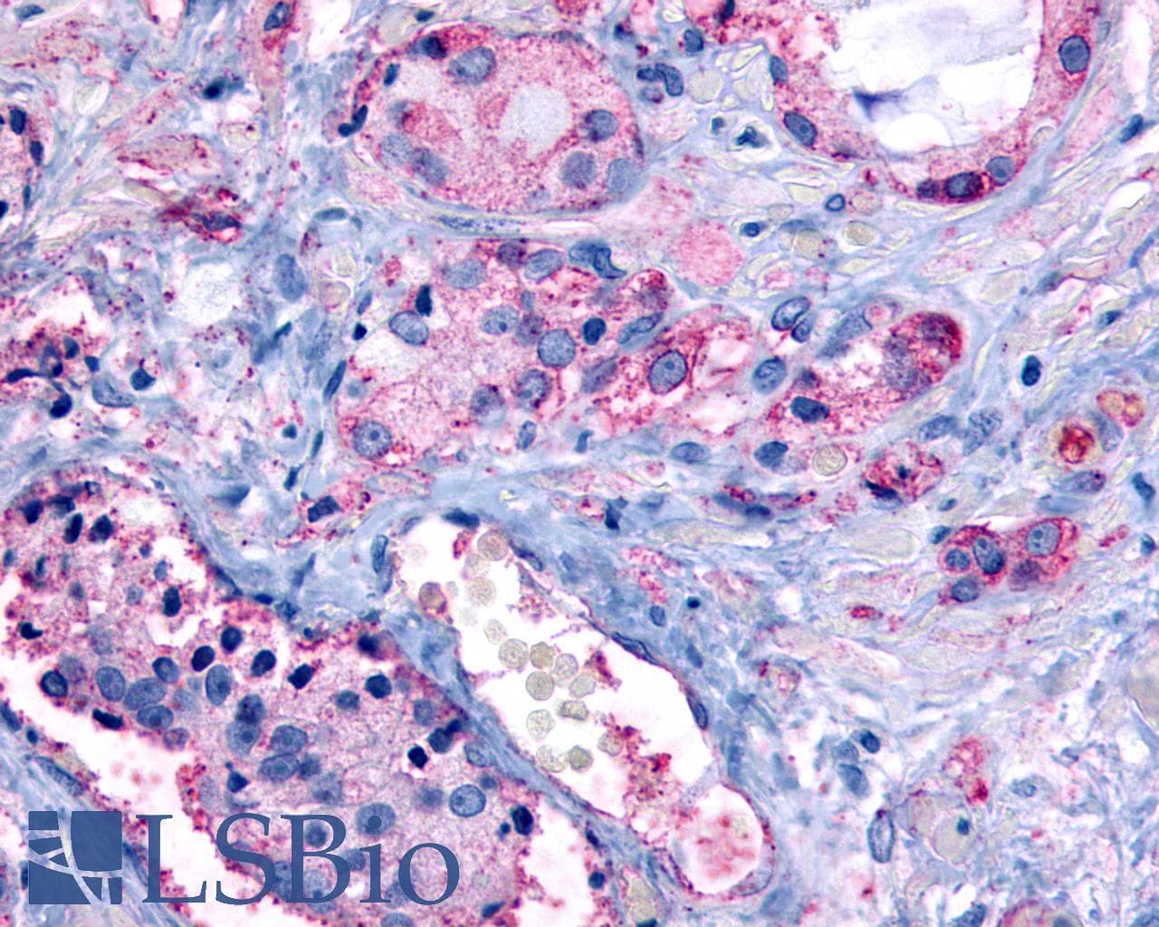 PathPlus™ Polyclonal Rabbit anti-Human GPR65 / TDAG8 Antibody (Cytoplasmic Domain, IHC)
