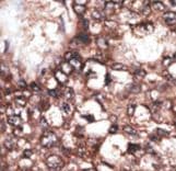 APOER2 / LRP8 Antibody (aa934-963)