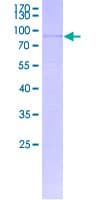 Human WNT10A Protein (Recombinant GST)