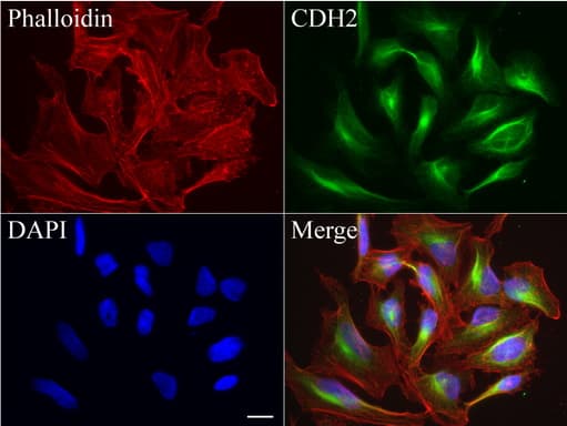 Monoclonal Mouse anti-Human CDH2 / N Cadherin Antibody (clone UMAB23, IHC, IF, WB)