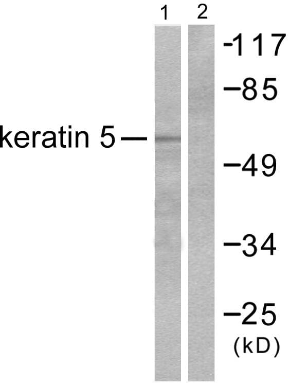 Polyclonal Rabbit anti-Human KRT5 / CK5 / Cytokeratin 5 Antibody (IHC, WB)