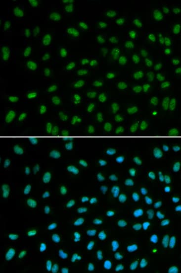 Polyclonal Rabbit anti-Human DDB2 Antibody (IHC, IF, WB)
