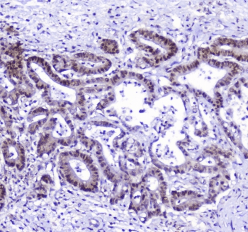 AHR Antibody