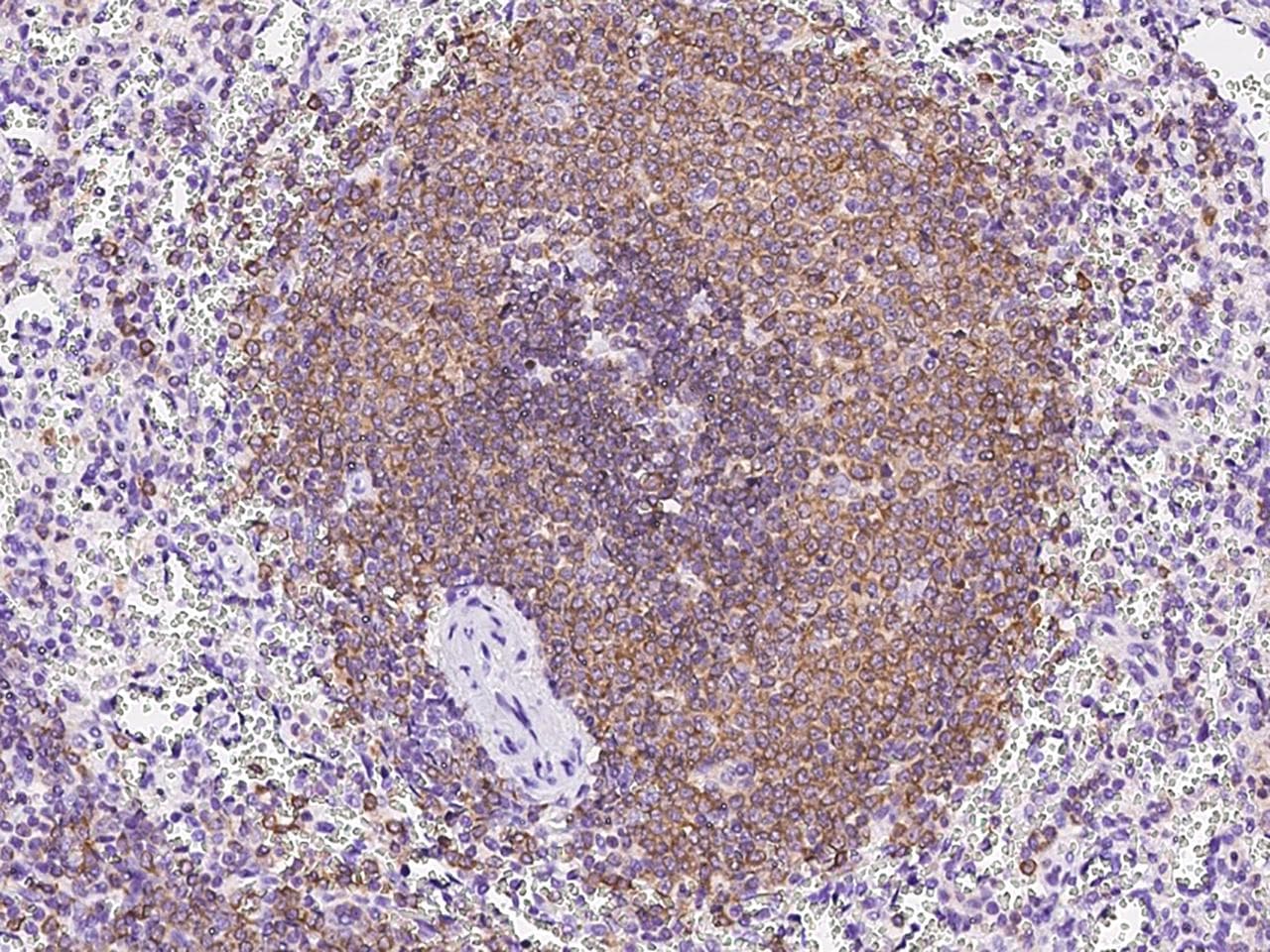 Polyclonal Rabbit anti-Human PTPN6 / SHP1 Antibody (IHC, WB)