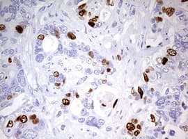 TOP2A / Topoisomerase II Alpha Antibody (aa1100-1531, clone 1D2, Carrier-free)