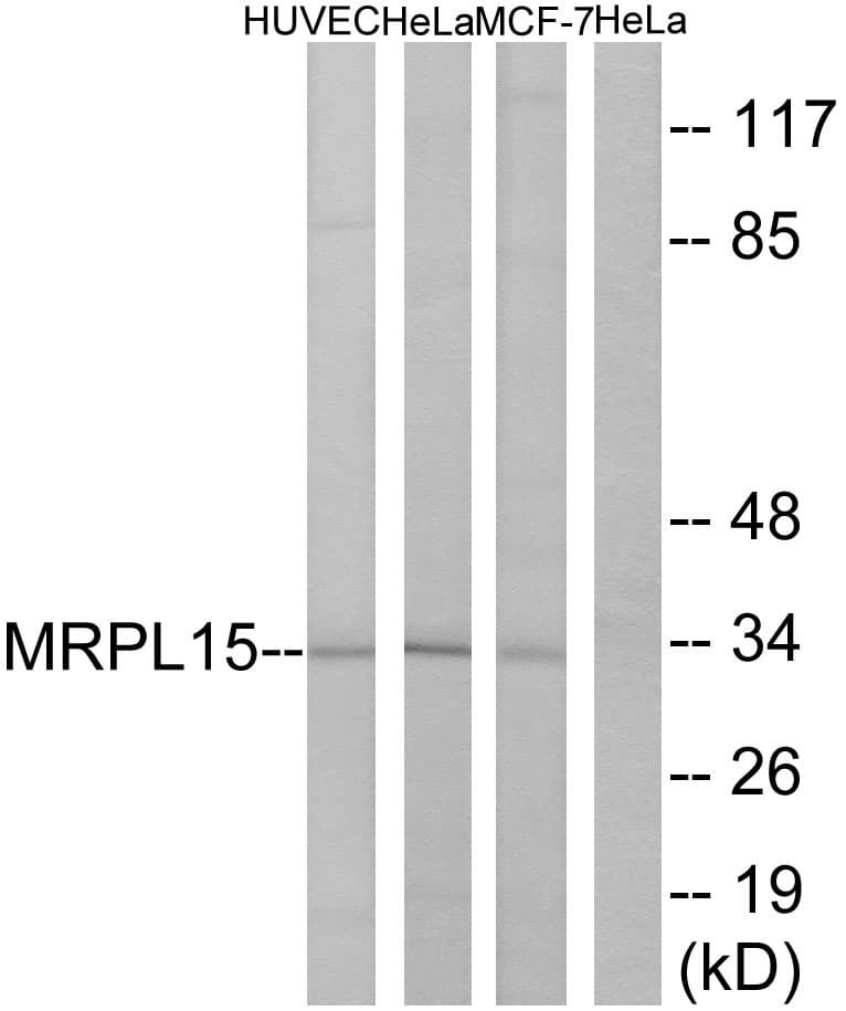 Polyclonal Rabbit anti-Human MRPL15 Antibody (aa191-240, WB)