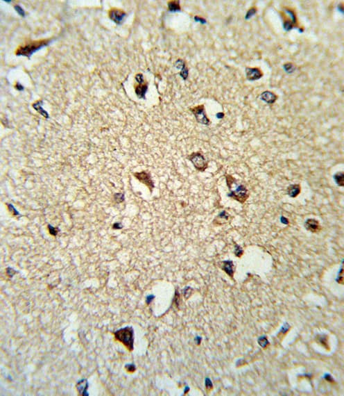 Polyclonal Rabbit anti-Human ARHGDIA / RHOGDI Antibody (aa112-140, IHC, WB)