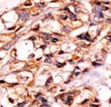 Polyclonal Rabbit anti-Human BAD Antibody (phospho-Ser118, IHC, WB)