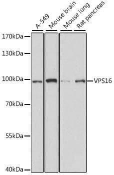 Polyclonal Rabbit anti-Human VPS16 Antibody (WB)