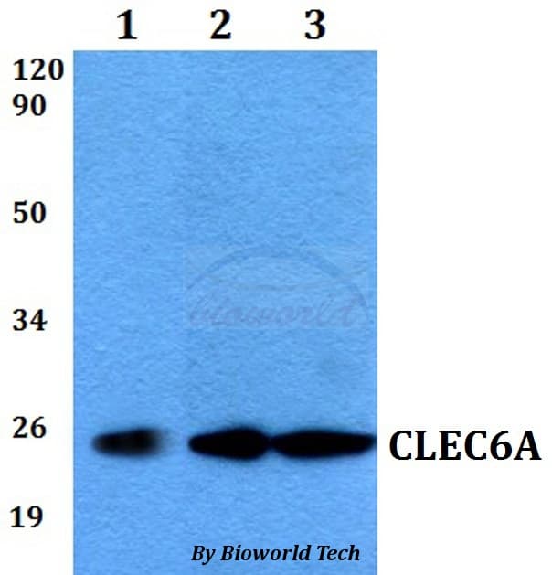 CLEC6A / Dectin 2 Antibody