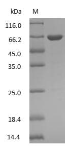 ALB / Serum Albumin Protein (Native)