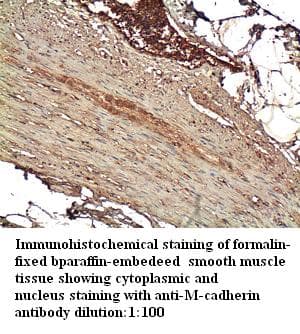 CDH15 / M Cadherin Antibody (Internal)