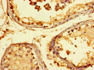 KIAA1267 Antibody